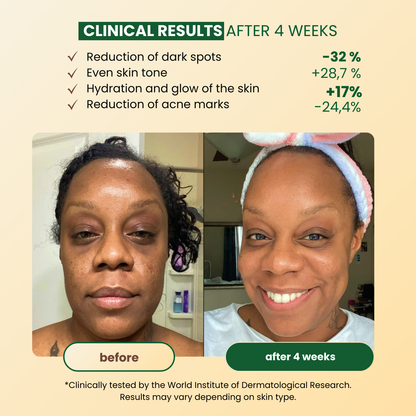 Turmeric Anti-Spots & Hyperpigmentation Soap (+ 2 FREE)