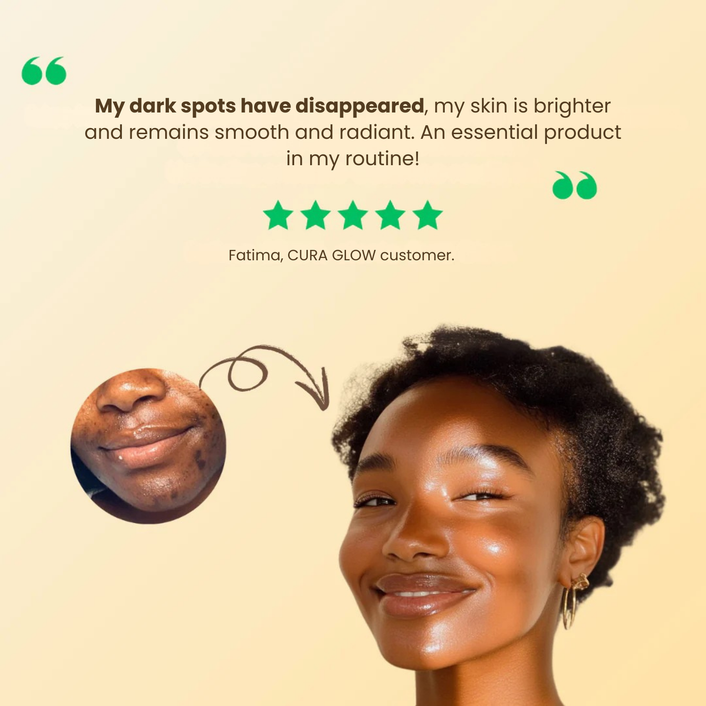 Turmeric Anti-Spots & Hyperpigmentation Soap (+ 2 FREE)